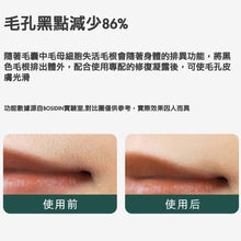 画像をギャラリービューアに読み込む, 英国🇬🇧BOSIDIN アイスクリーム脱毛器