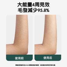 画像をギャラリービューアに読み込む, 英国🇬🇧BOSIDIN アイスクリーム脱毛器