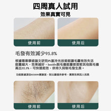 画像をギャラリービューアに読み込む, 英国🇬🇧BOSIDIN アイスクリーム脱毛器