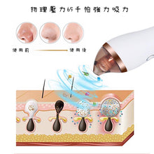 画像をギャラリービューアに読み込む, 黒ずみの器具👃🏻